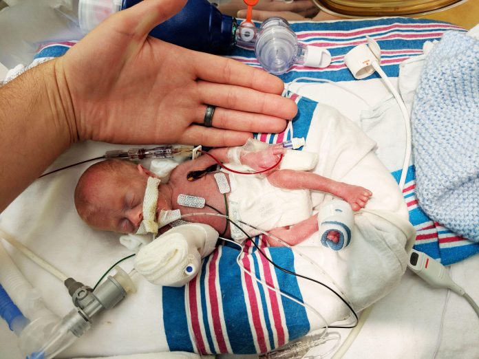 v tach preemie